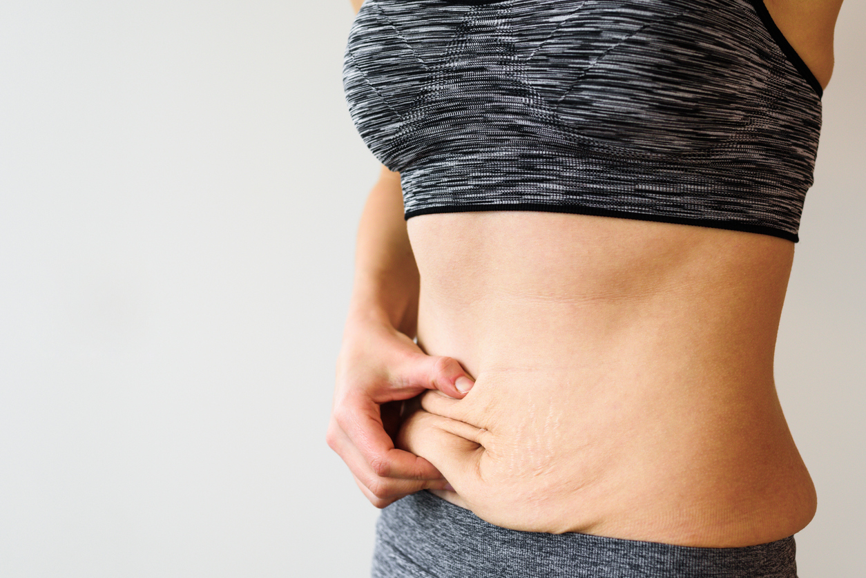 Woman belly with lose skin after dieting