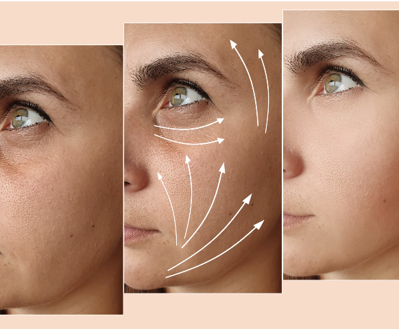 Facelifts vs. Non-Surgical Options: Making The Best Choice For You
