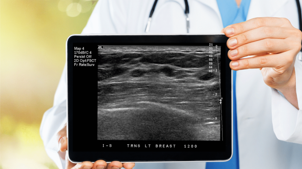 Why Adding Breast Ultrasounds to Traditional Imaging Is a Game Changer for Breast Implant Patients