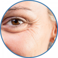 fine-lines woman-with-crows-feet-and-fine-wrinkles-around-eye