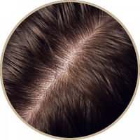 healthy-scalp healthy-scalp-after-lutronic-ultra-laser-treatment